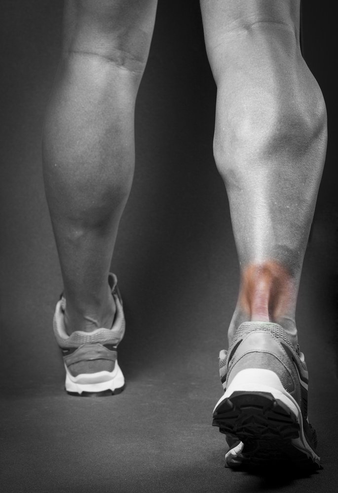 Achilles Tendinopathy What You Need To Know Wimbledon Clinics